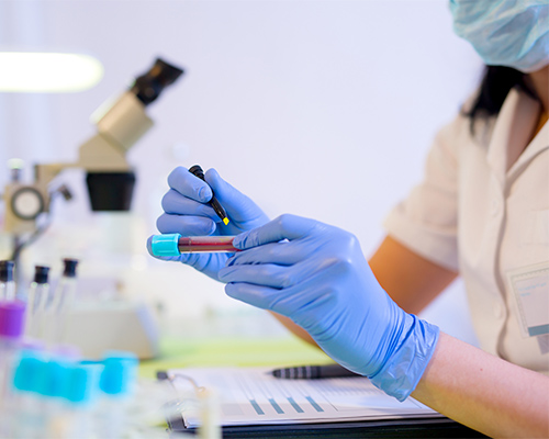 a lab worker holds a blood vial