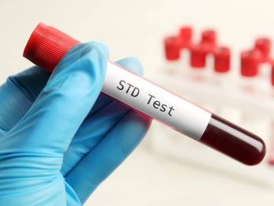STI Testing